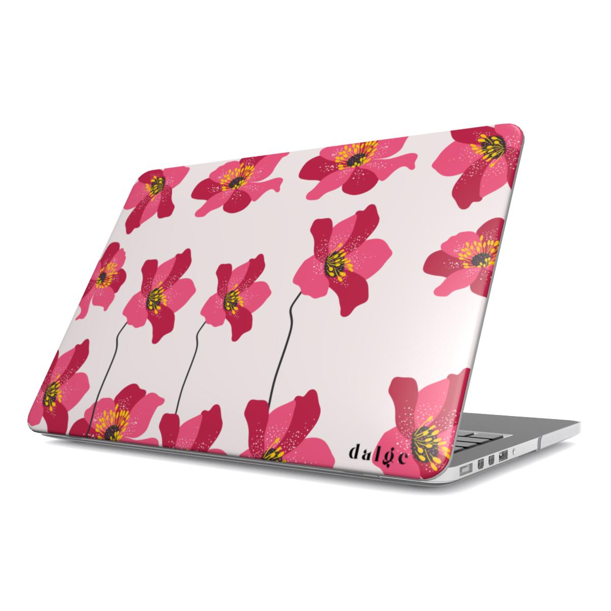 Spring Break Laptop Case | Floral designed MacBook Case from our Spring Edition Collection
